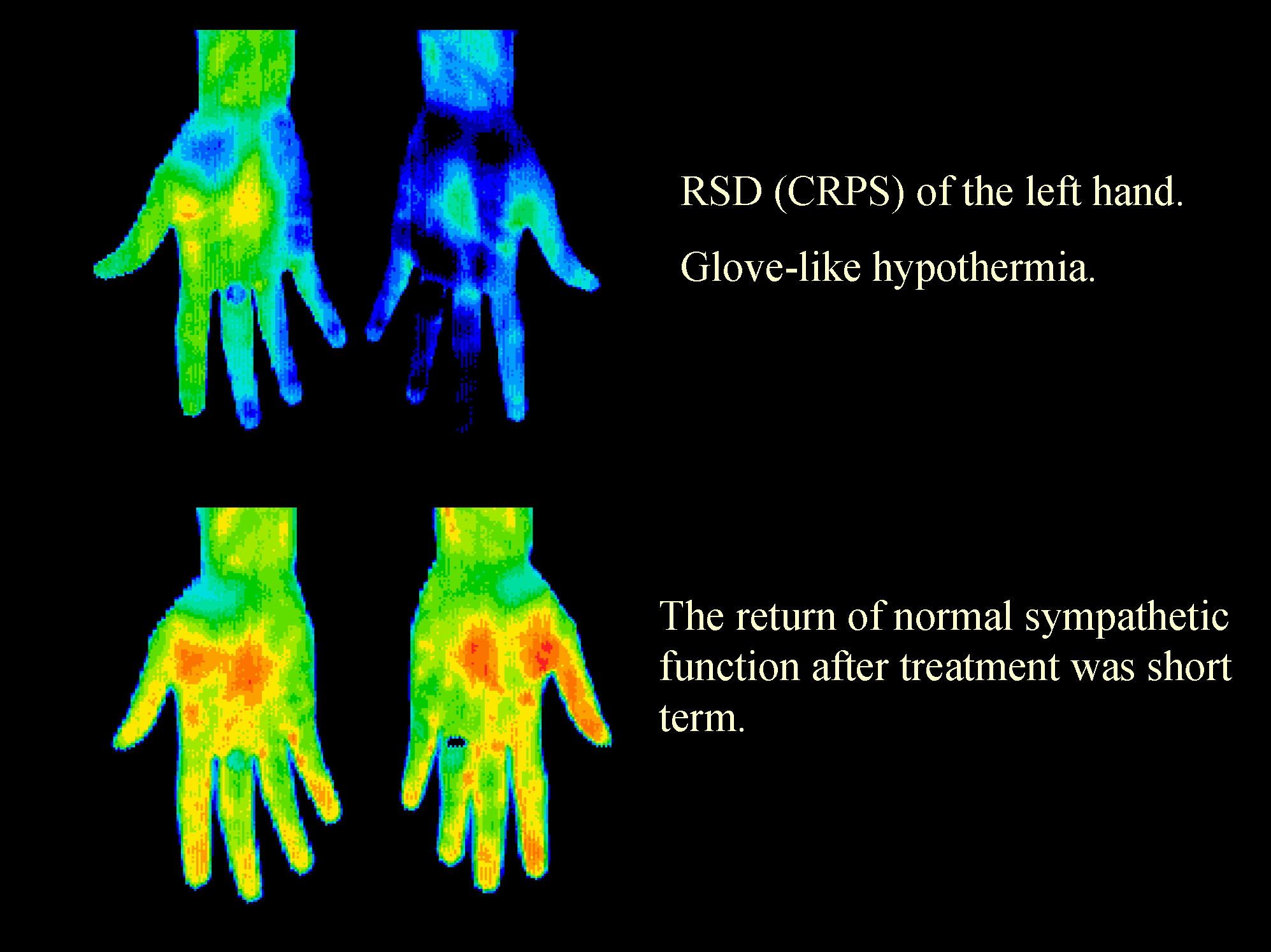 What is Thermal Imaging? — Gaston Thermal Imaging, Inc.